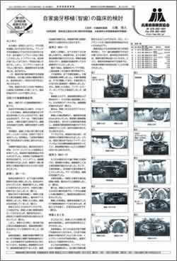 入れ歯は早めに